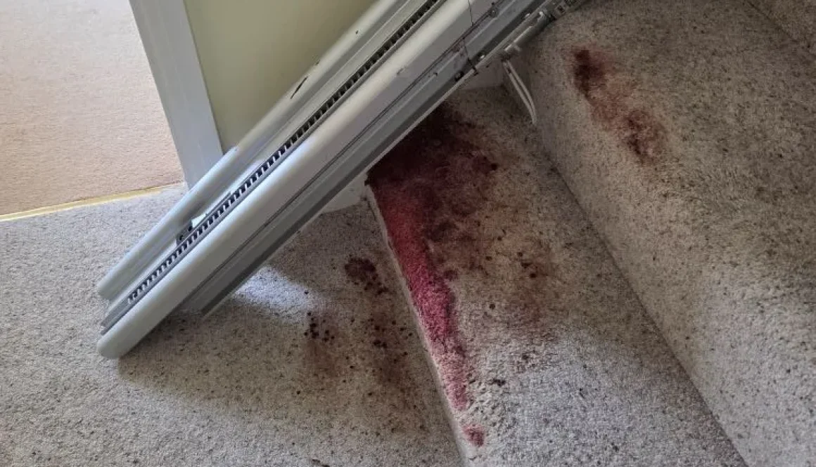 Stained staircase carpet in an Ely home before professional blood removal and deep extraction cleaning.